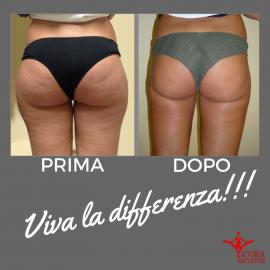 V-SHAPE